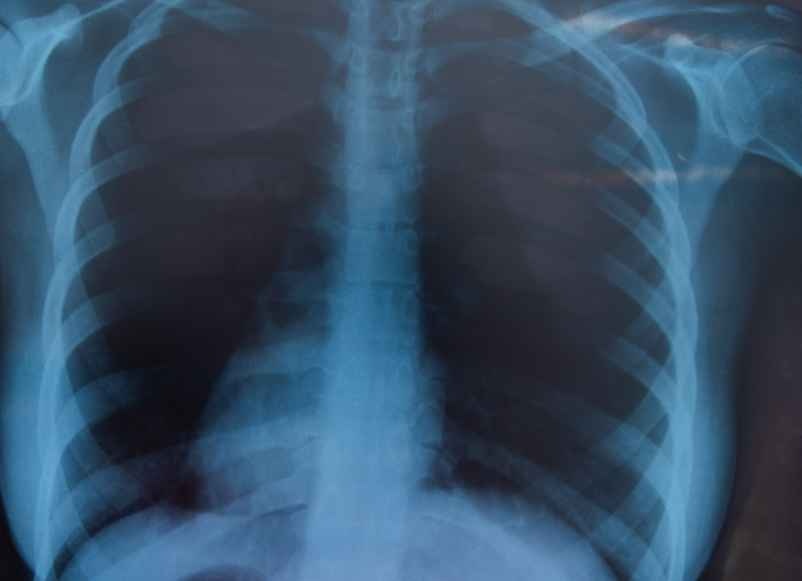 Posture et respiration pour limiter la douleur-Chez Requia