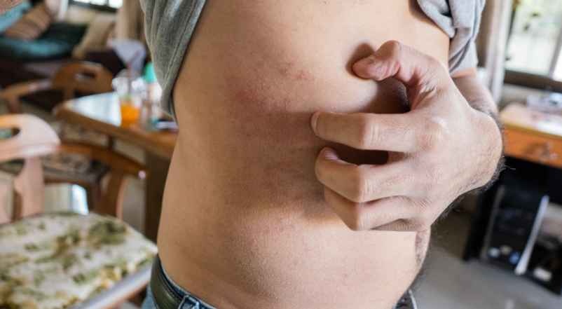 Suivi pour prévenir les complications-Chez Requia