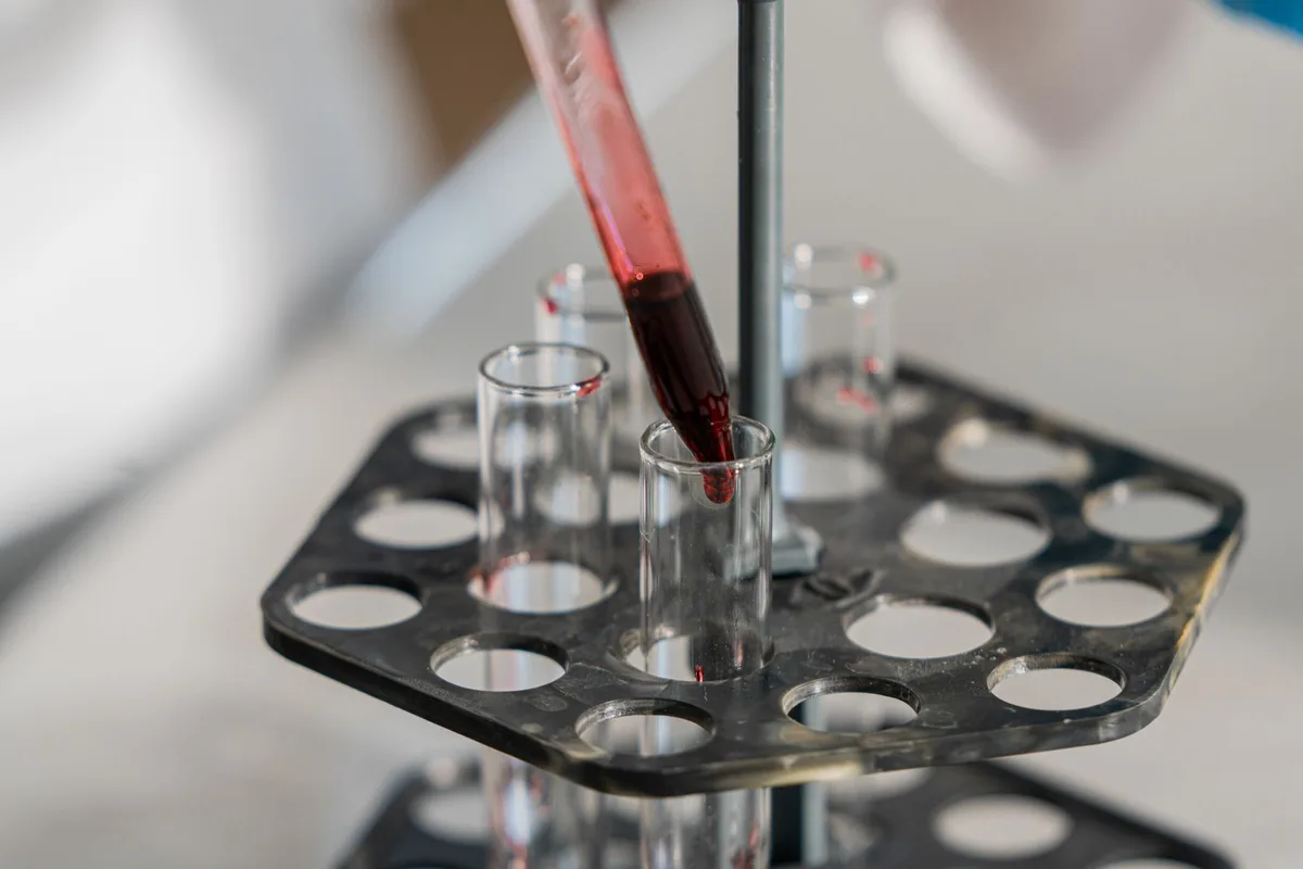 Professionnel de santé prélevant un échantillon de sang en laboratoire pour un dépistage.
