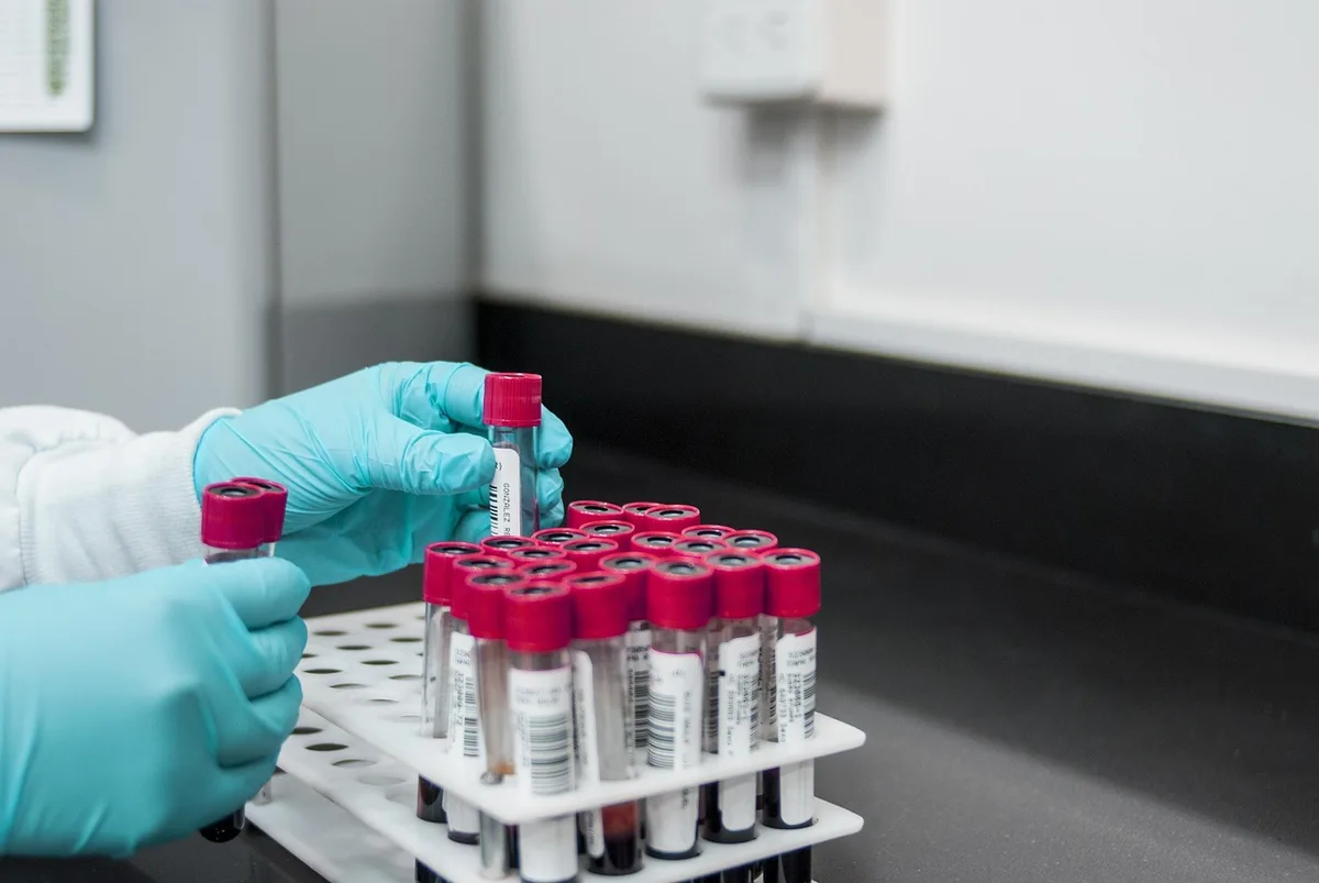 Prise de sang en laboratoire pour analyse de la fonction hépatique.