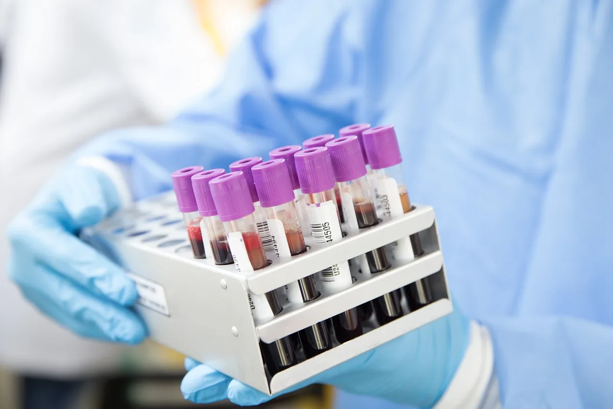 Technicien de laboratoire effectuant un test sanguin, pipette et échantillons biologiques
